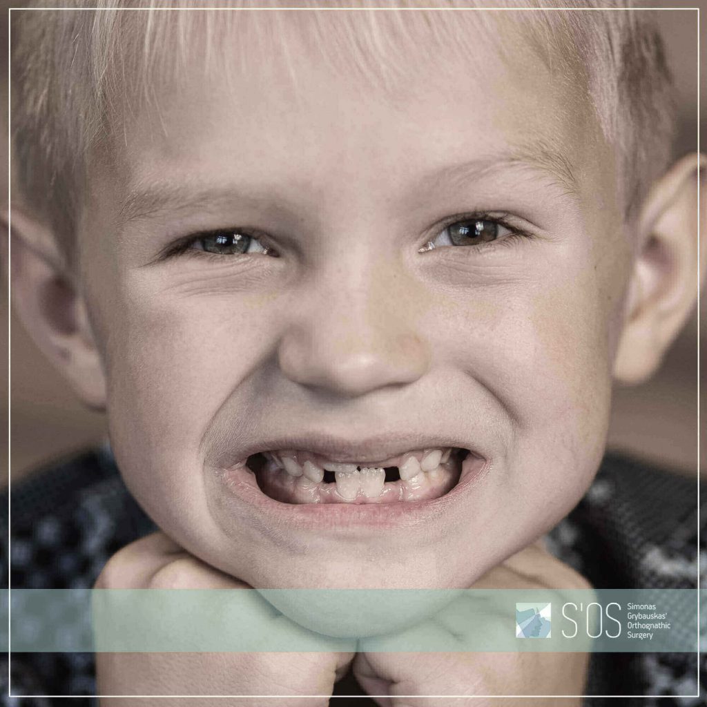 Ortodontinis vaikų gydymas -S'OS klinika